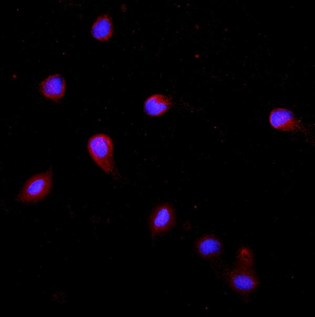Cytokeratin 20/Krt20 Antibody