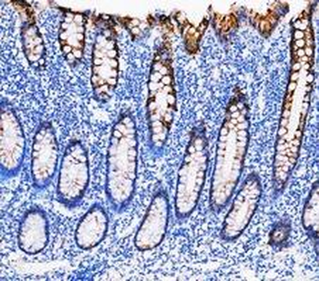 Cytokeratin 20/Krt20 Antibody