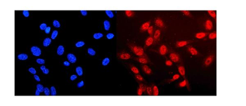 Neurofibromin/NF1 Antibody