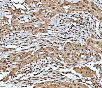 Neurofibromin/NF1 Antibody