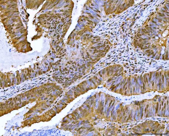 Neurofibromin/NF1 Antibody