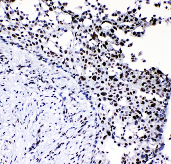 Neurofibromin/NF1 Antibody