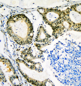 Neurofibromin/NF1 Antibody