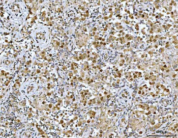 Neurofibromin/NF1 Antibody