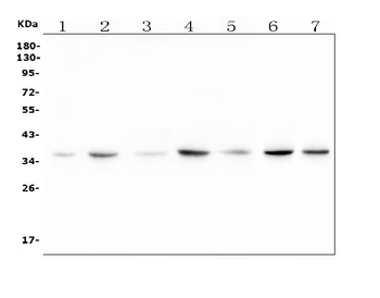 RTL10 Rabbit Polyclonal Antibody