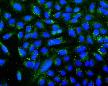 UGT1A6 Rabbit Polyclonal Antibody