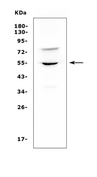 UGT1A6 Rabbit Polyclonal Antibody