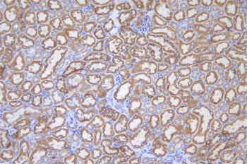 UGT1A6 Rabbit Polyclonal Antibody
