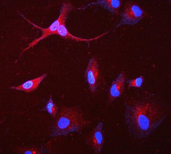 GAA Mouse Monoclonal Antibody