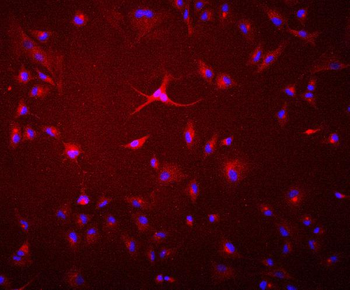 GAA Mouse Monoclonal Antibody