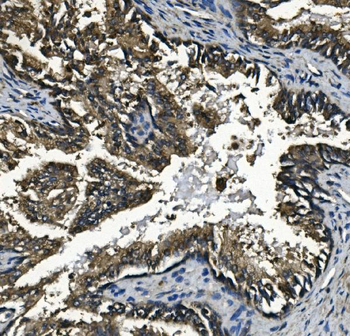GAA Mouse Monoclonal Antibody