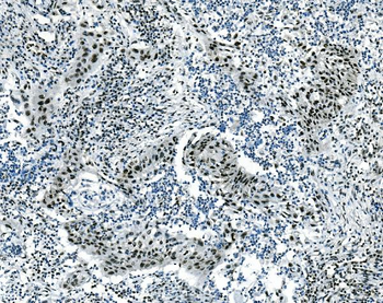 Musashi 1/Msi1 Antibody (monoclonal, 2B9)