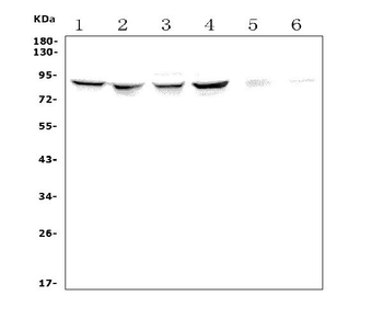 P5CS/ALDH18A1 Rabbit Polyclonal Antibody