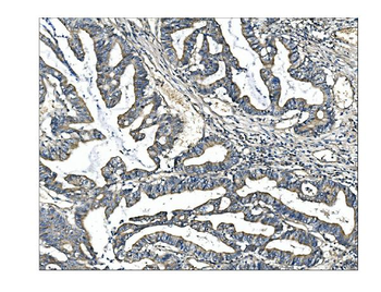 Angiopoietin-2/ANGPT2 Antibody