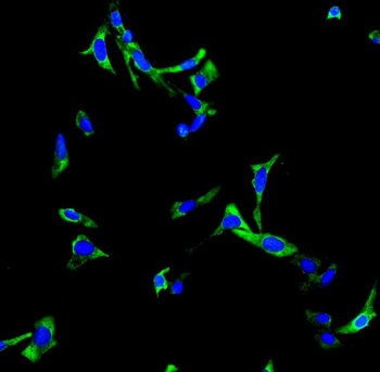 Choline Acetyltransferase/CHAT Rabbit Polyclonal Antibody