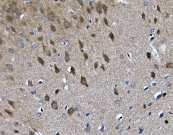 Choline Acetyltransferase/Chat Rabbit Polyclonal Antibody