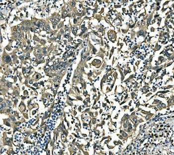 EIF4A1 Rabbit Polyclonal Antibody
