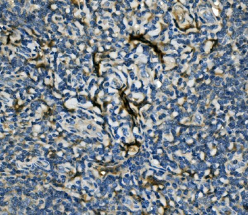 EIF4A1 Rabbit Polyclonal Antibody