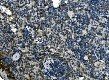 EIF4A1 Rabbit Polyclonal Antibody