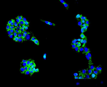 MC4-R/MC4R Antibody