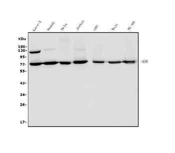 SENP1 Rabbit Polyclonal Antibody