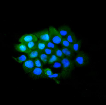 SLBP Rabbit Polyclonal Antibody