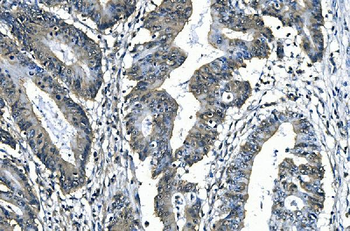 SLBP Rabbit Polyclonal Antibody