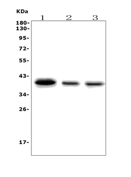 SLBP Rabbit Polyclonal Antibody