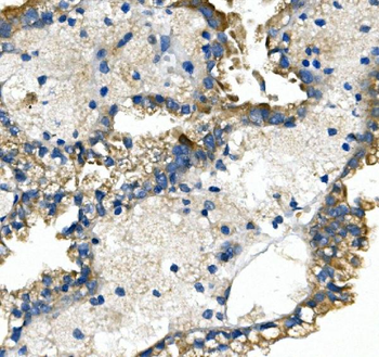 GLUT9/SLC2A9 Rabbit Polyclonal Antibody