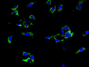 TLR1 TRIM6 Rabbit Polyclonal Antibody