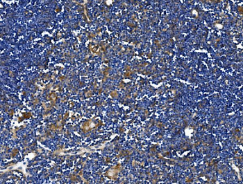 TLR1 TRIM6 Rabbit Polyclonal Antibody