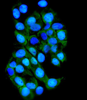TTK/Mps1/TTK Rabbit Polyclonal Antibody