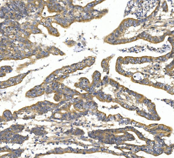 TTK/Mps1/TTK Rabbit Polyclonal Antibody