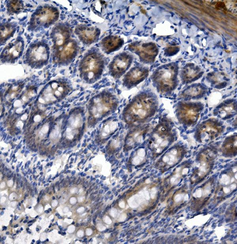 TTK/Mps1/TTK Rabbit Polyclonal Antibody