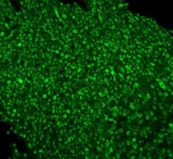 PTBP1 Antibody (monoclonal, 3H12)