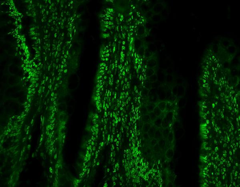 PTBP1 Antibody (monoclonal, 3H12)