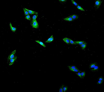 Beta Tubulin Mouse Monoclonal Antibody