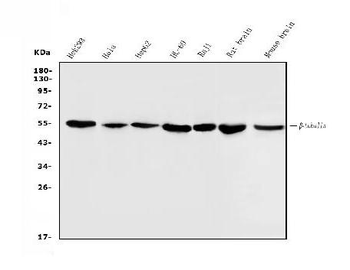 Beta Tubulin Mouse Monoclonal Antibody