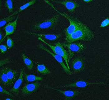 Cytokeratin 18 KRT18 Mouse Monoclonal Antibody