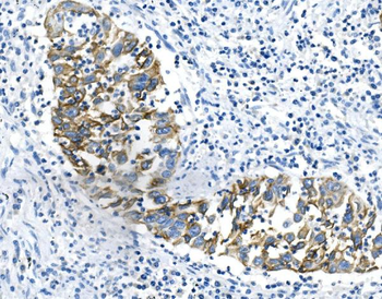 Cytokeratin 18 KRT18 Mouse Monoclonal Antibody