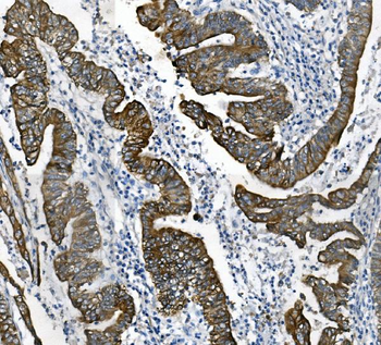 Cytokeratin 18 KRT18 Mouse Monoclonal Antibody