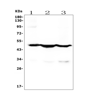 Cytokeratin 18 KRT18 Mouse Monoclonal Antibody