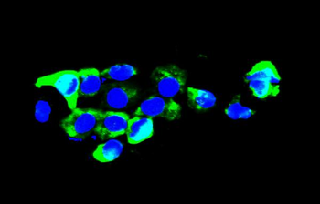 Agrin/AGRN Rabbit Polyclonal Antibody