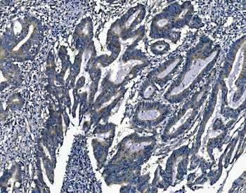 Agrin/AGRN Rabbit Polyclonal Antibody