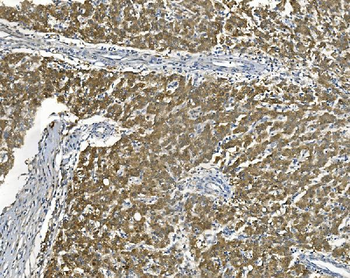 AKR7A2 Picoband® Rabbit Polyclonal Antibody