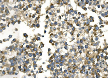 AKR7A2 Picoband® Rabbit Polyclonal Antibody