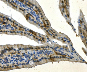 AKR7A2 Picoband® Rabbit Polyclonal Antibody