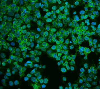 ASS1 Rabbit Polyclonal Antibody