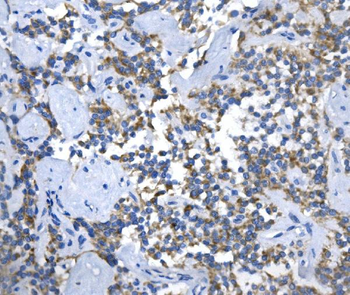 ASS1 Rabbit Polyclonal Antibody