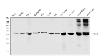 ASS1 Rabbit Polyclonal Antibody